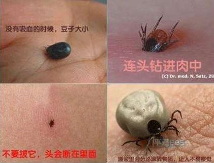 头上长虱子怎么办?虱子怎么去除?去虱子和虱子卵的有效方法