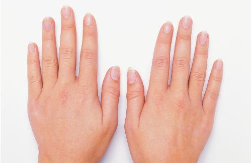 从指甲上竟然看出这么多病症